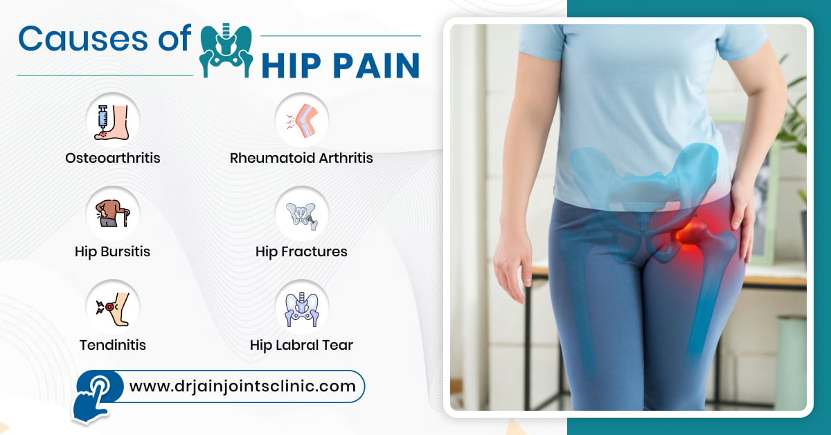 Causes of Hip Pain