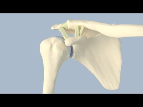  AC Joint Dislocation