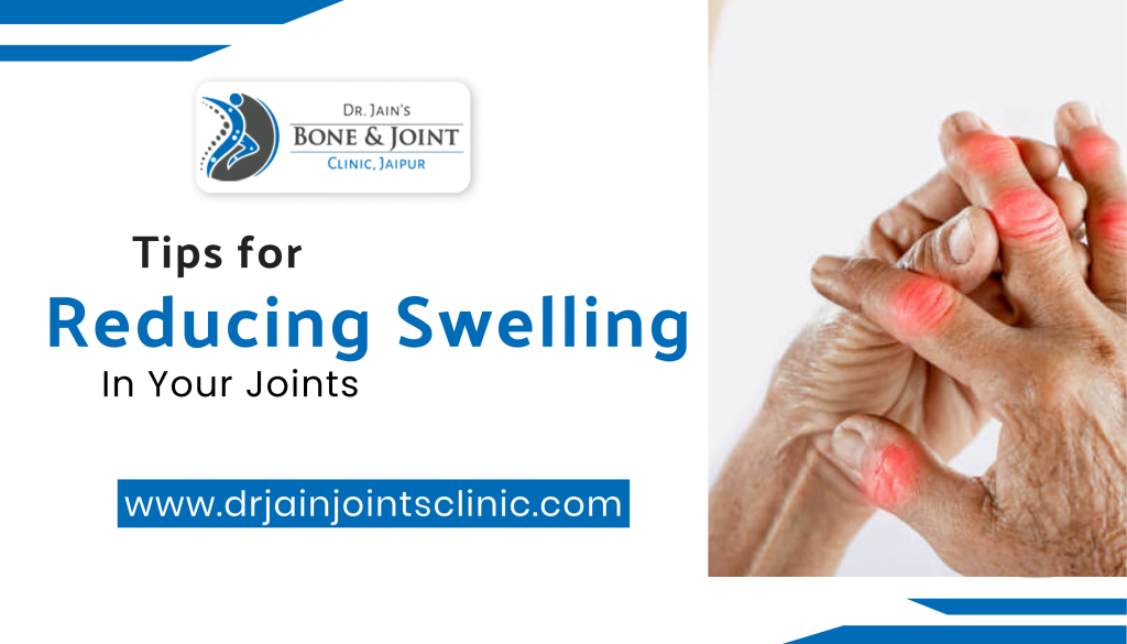 Tips for Reducing Swelling In Your Joints